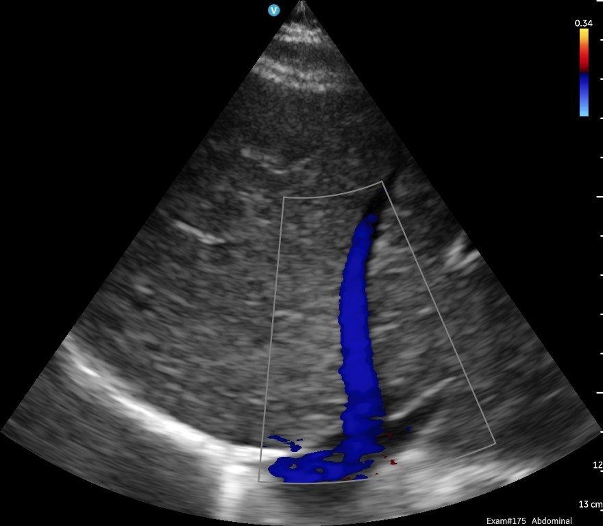 GE HealthCare Handheld Ultrasound image